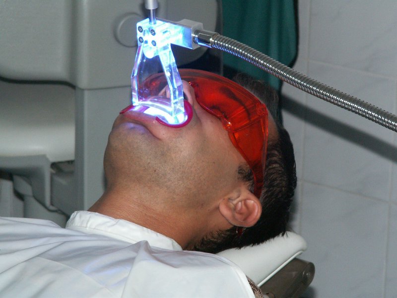 Teeth whitening with LED lights